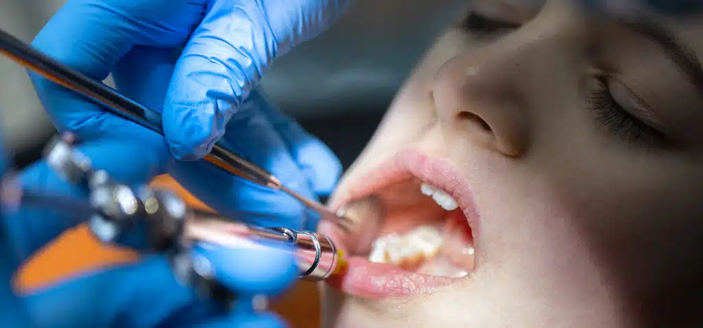 Preventive Dentistry