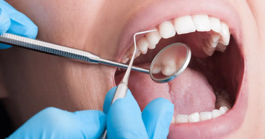 Routine Cleanings & Exams - Siebenthaler Dental - featured image